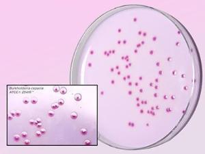 HardyCHROM™ Bcc, chromogenic medium for&nbsp;<i>Burkholderia cepacia</i>