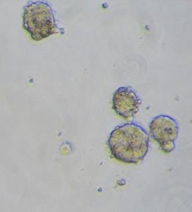 Human iPSC-derived CD14+ Monocytes
