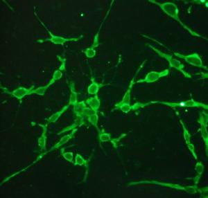 Human iPSC-derived Motor Neurons
