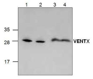 Western blot analysis of VENTX using Jurkat cell lysate (Lane 1& 2), 3T3 mouse lysate (Lane 3) and rat kidney tissue lysate (Lane 4).