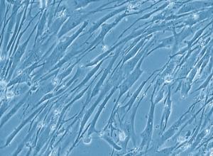 Human Aortic Smooth Muscle Cells (HAoSMC), PromoCell