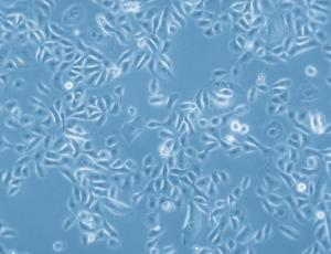 Human Bronchial Epithelial Cells (HBEpC), PromoCell