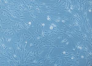 Human Bronchial Smooth Muscle Cells (HBSMC), PromoCell