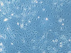 Human dermal microvascular endothelial cells (HDMEC), PromoCell