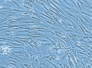 Human Pulmonary Artery Smooth Muscle Cells (HPASMC), PromoCell