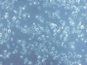 Human Small Airway Epithelial Cells (HSAEpC), PromoCell