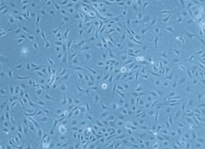 Human umbilical artery endothelial cells (HUAEC), PromoCell