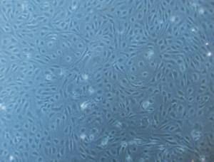 Human Uterine Microvascular Endothelial Cells (HUtMEC), PromoCell