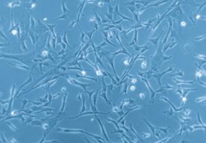 Human Mesenchymal Stem Cells from Umbilical Cord Matrix (hMSC-UC), PromoCell