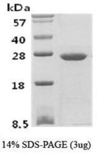 Human Recombinant Phosphoserine phosphatase (from <i>E. coli</i>)