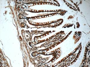 Anti-CHK1 Mouse Monoclonal Antibody [clone: 3A3A5]