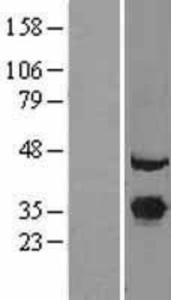 Exosome component 7 Overexpression Lysate (Adult Normal), Novus Biologicals (NBL1-10388)