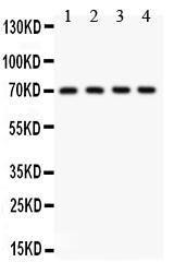 Anti-KCNMA1 Polyclonal Antibody