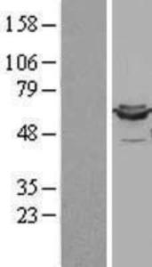 Lipoamide Dehydrogenase Overexpression Lysate (Adult Normal), Novus Biologicals (NBL1-09909)