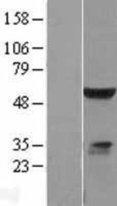 ELK4 Overexpression Lysate (Adult Normal), Novus Biologicals (NBL1-10234)