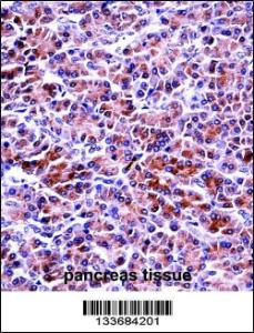PRSS2 Antibody immunohistochemistry analysis in formalin fixed and paraffin embedded human pancreas tissue followed by peroxidase conjugation of the secondary antibody and DAB staining