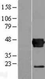 Coxsackie Adenovirus Receptor Overexpression Lysate (Adult Normal), Novus Biologicals (NBL1-09620)