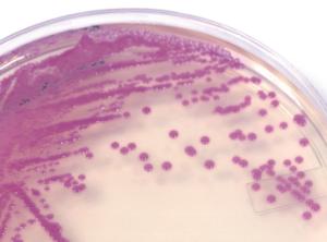 HardyCHROM™ Staphylococcus aureus, Hardy Diagnostics