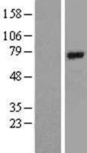 BMAL1 Overexpression Lysate (Adult Normal), Novus Biologicals (NBL1-07723)