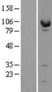 EPB41L1 Overexpression Lysate (Adult Normal), Novus Biologicals (NBL1-10287)
