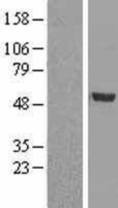 Arrestin beta 1 Overexpression Lysate (Adult Normal), Novus Biologicals (NBL1-07732)