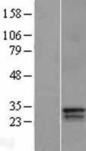 BP1 Overexpression Lysate (Adult Normal), Novus Biologicals (NBL1-09919)