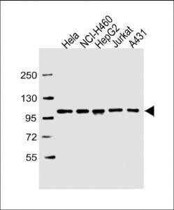 Western Blot at 1:2000 dilution Lane 1: Hela whole cell lysate Lane 2: NCI-H460 whole cell lysate Lane 3: HepG2 whole cell lysate Lane 4: Jurkat whole cell lysate Lane 5: A431 whole cell lysate Lysates/proteins at 20 µg per lane