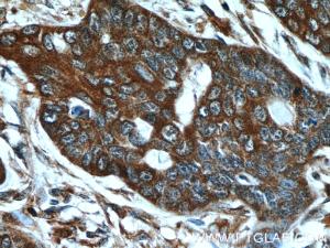 Anti-MMP21 Rabbit Polyclonal Antibody