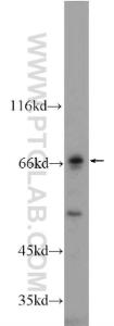 Anti-MMP21 Rabbit Polyclonal Antibody