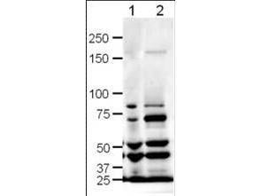 Anti-SLIT1 Rabbit Polyclonal Antibody