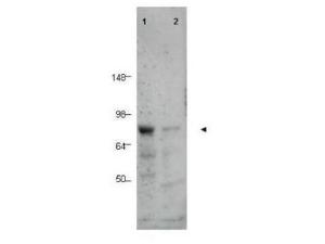Anti-CTCFL Rabbit Polyclonal Antibody