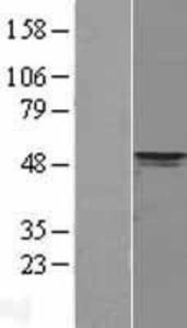 PDK4 Overexpression Lysate (Adult Normal), Novus Biologicals (NBL1-14252)