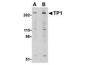 Anti-TEP1 Rabbit Polyclonal Antibody