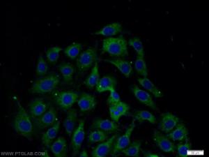 Anti-CSK Rabbit Polyclonal Antibody