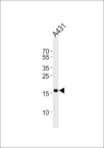 Western blot analysis of lysate from A431 cell line, using DUT Antibody at 1:1000 at each lane
