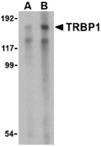 Western blot analysis of TRBP1 in 3T3 cell lysate with TRBP1 antibody at (A) 1 and (B) 2 ug/mL.