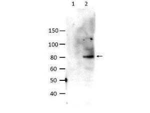 Anti-STAT6 Rabbit Polyclonal Antibody