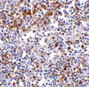 Immunohistochemistry of MDA5 in human lymph node tissue with MDA5 antibody at 5 µg/ml.