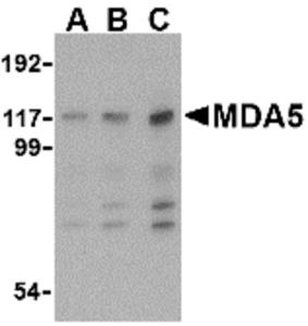 Western blot analysis of MDA5 in Daudi cell lysate with MDA5 antibody at (A) 1, (B) 2 and (C) 4 ug/mL.