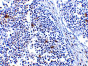 Immunohistochemistry of MDA5 in human lymph node tissue with MDA5 antibody at 5 µg/ml.
