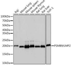 Western blot analysis of extracts of various cell lines, using Anti-Proteasome 20S LMP2 Antibody [ARC1629] (A308367) at 1:1000 dilution. The secondary Antibody was Goat Anti-Rabbit IgG H&L Antibody (HRP) at 1:10000 dilution