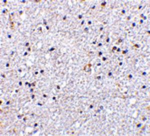 Immunohistochemistry of VISA in human brain tissue with VISA antibody at 5 µg/ml.