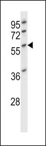 Western blot analysis in HL-60 cell line lysates (35 µg/lane) This demonstrates the DES antibody detected the DES protein (arrow)