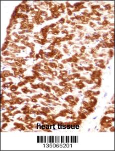DES/Desmin (Muscle Cell Marker) Antibody immunohistochemistry analysis in formalin fixed and paraffin embedded human heart tissue followed by peroxidase conjugation of the secondary antibody and DAB staining
