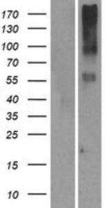 OR14I1 Lysate (Adult Normal), Novus Biologicals (NBP2-08905)