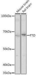 Western blot analysis of extracts of various cell lines, using Anti-FTO Antibody (A307471) at 1:1,000 dilution The secondary antibody was Goat Anti-Rabbit IgG H&L Antibody (HRP) at 1:10,000 dilution Lysates/proteins were present at 25 µg per lane