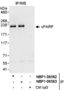 Human Recombinant Phosphoserine phosphatase (from <i>E. coli</i>)