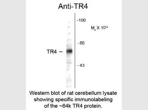 Testicular receptor 4 (TR4) AN