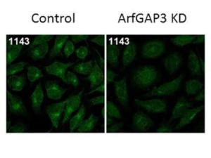 ARFGAP3 antibody 100 µl