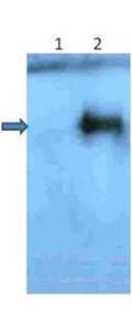 Anti-beta Amyloid pyro E3 Immunofluorescence